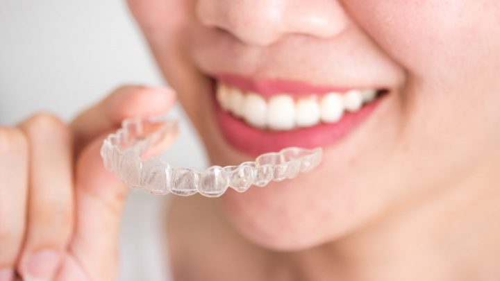 Porcelain veneers is best for aesthetic dental treatment